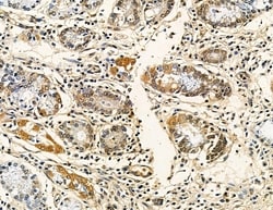 Invitrogen CHRAC1 Polyclonal Antibody 100 &mu;L; Unconjugated:Antibodies,