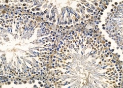 Invitrogen CHRAC1 Polyclonal Antibody 100 &mu;L; Unconjugated:Antibodies,