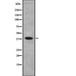 Invitrogen MBIP Polyclonal Antibody 100 &mu;L | Buy Online | Invitrogen&trade; | Fisher Scientific