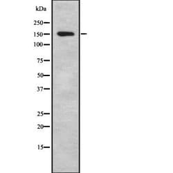 Invitrogen IBTK Polyclonal Antibody 100 &mu;L; Unconjugated:Antibodies,