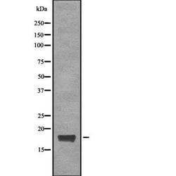 Invitrogen CGGBP1 Polyclonal Antibody 100 &mu;L; Unconjugated:Antibodies,