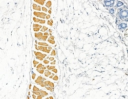 Invitrogen AKAP11 Polyclonal Antibody 100 &mu;L; Unconjugated:Antibodies,