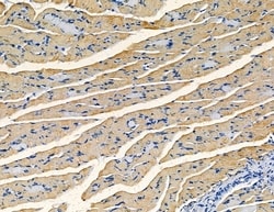 Invitrogen AKAP11 Polyclonal Antibody 100 &mu;L; Unconjugated:Antibodies,