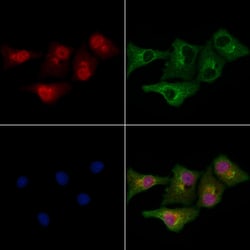 Invitrogen MLL4 Polyclonal Antibody 100 &mu;L; Unconjugated:Antibodies,