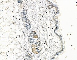 Invitrogen COL7A1 Polyclonal Antibody 100 &mu;L; Unconjugated:Antibodies,
