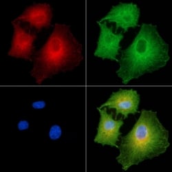 Invitrogen COL8A1 Polyclonal Antibody 100 &mu;L; Unconjugated:Antibodies,