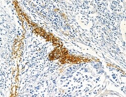 Invitrogen COL8A1 Polyclonal Antibody 100 &mu;L; Unconjugated:Antibodies,