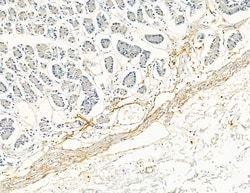 Invitrogen COL8A1 Polyclonal Antibody 100 &mu;L; Unconjugated:Antibodies,