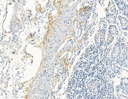 Invitrogen COL8A1 Polyclonal Antibody 100 &mu;L; Unconjugated:Antibodies,