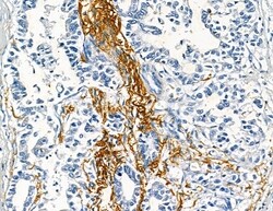 Invitrogen COL8A1 Polyclonal Antibody 100 &mu;L; Unconjugated:Antibodies,