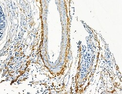 Invitrogen COL8A1 Polyclonal Antibody 100 &mu;L; Unconjugated:Antibodies,