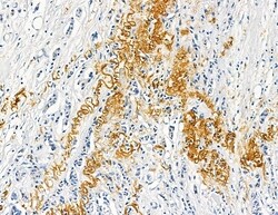 Invitrogen COL8A1 Polyclonal Antibody 100 &mu;L; Unconjugated:Antibodies,