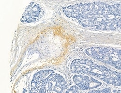 Invitrogen COL8A1 Polyclonal Antibody 100 &mu;L; Unconjugated:Antibodies,