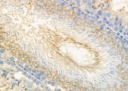 Invitrogen COL9A1 Polyclonal Antibody 100 &mu;L; Unconjugated:Antibodies,