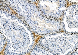 Invitrogen COL16A1 Polyclonal Antibody 100 &mu;L; Unconjugated:Antibodies,