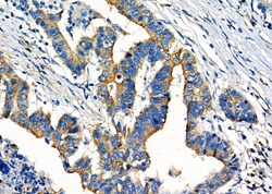 Invitrogen COX15 Polyclonal Antibody 100 &mu;L; Unconjugated:Antibodies,