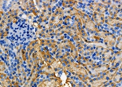 Invitrogen COX15 Polyclonal Antibody 100 &mu;L; Unconjugated:Antibodies,
