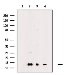 COX5B Polyclonal Antibody:Antibodies, Polyclonal