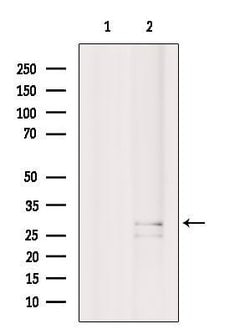 Invitrogen CD320 Polyclonal Antibody 100 &mu;L; Unconjugated:Antibodies,