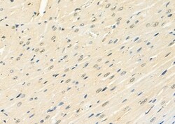 Invitrogen CIDEC Polyclonal Antibody 100 &mu;L; Unconjugated:Antibodies,