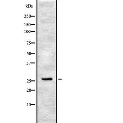 Invitrogen CIDEC Polyclonal Antibody 100 &mu;L; Unconjugated:Antibodies,