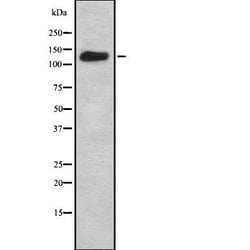 Adenylate Cyclase 7 Polyclonal Antibody, Invitrogen 100 &mu;L; Unconjugated:Antibodies,