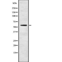 Invitrogen CYP4F3 Polyclonal Antibody 100 &mu;L; Unconjugated:Antibodies,
