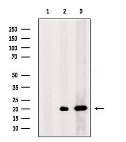 Invitrogen COX7A2 Polyclonal Antibody 100 &mu;L | Buy Online | Invitrogen&trade; | Fisher Scientific