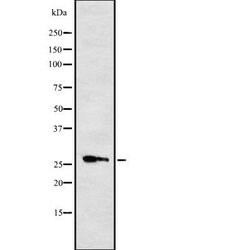 Invitrogen CYB561 Polyclonal Antibody 100 &mu;L; Unconjugated:Antibodies,