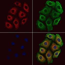 Invitrogen CALY Polyclonal Antibody 100 &mu;L; Unconjugated:Antibodies,