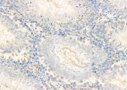 Invitrogen CALY Polyclonal Antibody 100 &mu;L; Unconjugated:Antibodies,