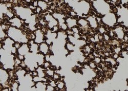 Invitrogen DNAJB5 Polyclonal Antibody 100 &mu;L | Buy Online | Invitrogen&trade; | Fisher Scientific