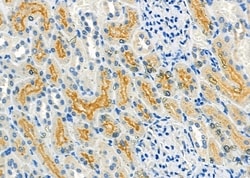 Invitrogen FGF16 Polyclonal Antibody 100 &mu;L; Unconjugated:Antibodies,