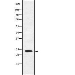 Invitrogen FGF16 Polyclonal Antibody 100 &mu;L; Unconjugated:Antibodies,