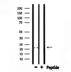 Invitrogen FGF6 Polyclonal Antibody 100 &mu;L; Unconjugated:Antibodies,