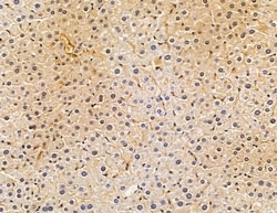 Invitrogen FGFBP3 Polyclonal Antibody 100 &mu;L | Buy Online | Invitrogen&trade; | Fisher Scientific