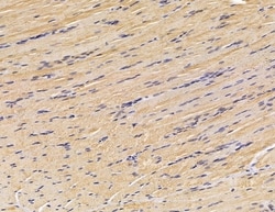 Invitrogen FGFBP3 Polyclonal Antibody 100 &mu;L | Buy Online | Invitrogen&trade; | Fisher Scientific