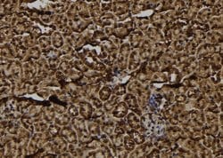 Invitrogen FKSG2 Polyclonal Antibody 100 &mu;L; Unconjugated:Antibodies,