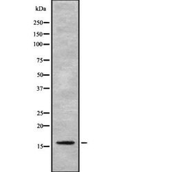 Invitrogen FKSG2 Polyclonal Antibody 100 &mu;L; Unconjugated:Antibodies,