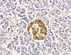 Invitrogen GTSE1 Polyclonal Antibody 100 &mu;L; Unconjugated:Antibodies,