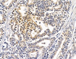 Invitrogen HSBP1 Polyclonal Antibody 100 &mu;L; Unconjugated:Antibodies,