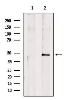 Invitrogen IL10RB Polyclonal Antibody 100 &mu;L | Buy Online | Invitrogen&trade; | Fisher Scientific