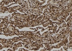 Invitrogen ICEBERG Polyclonal Antibody 100 &mu;L; Unconjugated:Antibodies,