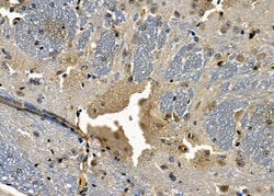Invitrogen ICEBERG Polyclonal Antibody 100 &mu;L; Unconjugated:Antibodies,