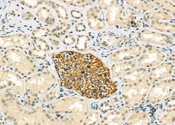 IFNA14 Polyclonal Antibody:Antibodies, Polyclonal