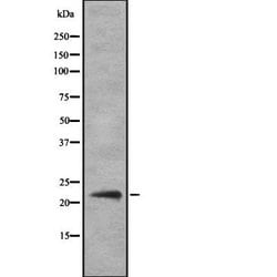 IFNA14 Polyclonal Antibody:Antibodies, Polyclonal