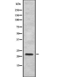Invitrogen IFNA7/IFNA16 Polyclonal Antibody 100 &mu;L; Unconjugated:Antibodies,