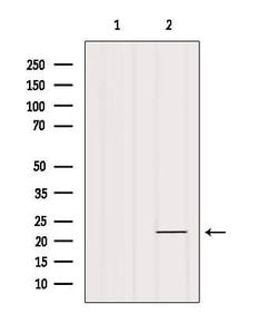 IFNA17 Polyclonal Antibody, Invitrogen 100 &mu;L; Unconjugated:Antibodies,
