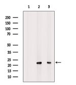 Interferon alpha-21 Polyclonal Antibody, Invitrogen™