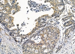 Invitrogen IFNA5 Polyclonal Antibody 100 &mu;L; Unconjugated:Antibodies,